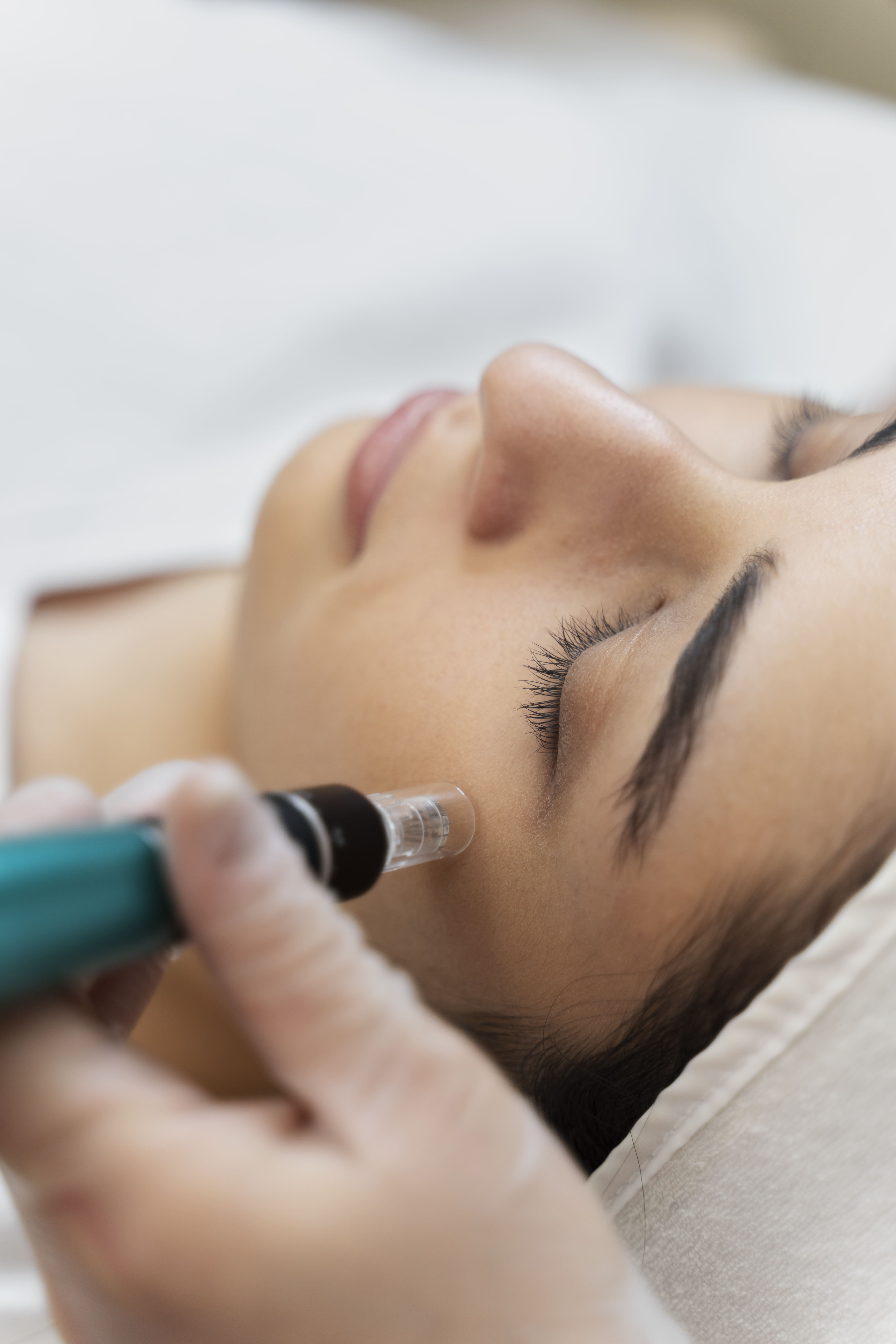 Preenchimento Facial